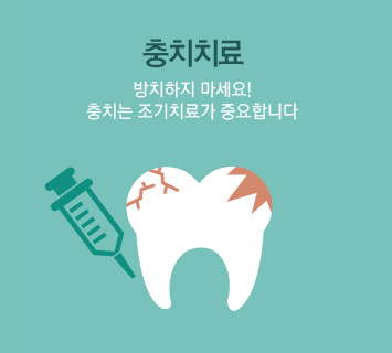 충치치료 방치하지 마세요! 충치는 조기치료가 중요합니다